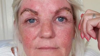 JANE FOI AO SALÃO DE UNHAS PARA FAZER TRATAMENTOS QUE TERMINARAM EM DESASTRE. SEU ROSTO INCHOU E SUAS SOBRANCELHAS FICARAM PARECENDO “DUAS LESMAS NEGRAS”