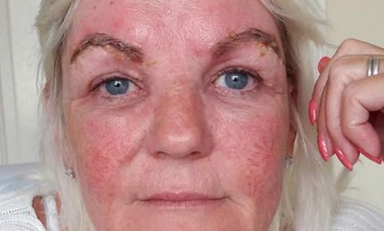JANE FOI AO SALÃO DE UNHAS PARA FAZER TRATAMENTOS QUE TERMINARAM EM DESASTRE. SEU ROSTO INCHOU E SUAS SOBRANCELHAS FICARAM PARECENDO “DUAS LESMAS NEGRAS” JANE FOI AO SALÃO DE UNHAS PARA FAZER TRATAMENTOS QUE TERMINARAM EM DESASTRE. SEU ROSTO INCHOU E SUAS SOBRANCELHAS FICARAM PARECENDO “DUAS LESMAS NEGRAS”