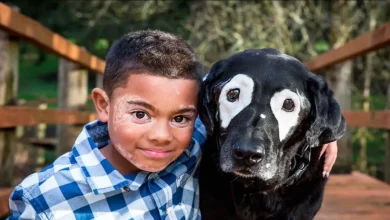 Garoto Envergonhado por Condição de Pele Fica Radiante ao Conhecer Cão com a Mesma