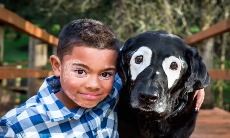 Garoto Envergonhado por Condição de Pele Fica Radiante ao Conhecer Cão com a Mesma Garoto Envergonhado por Condição de Pele Fica Radiante ao Conhecer Cão com a Mesma